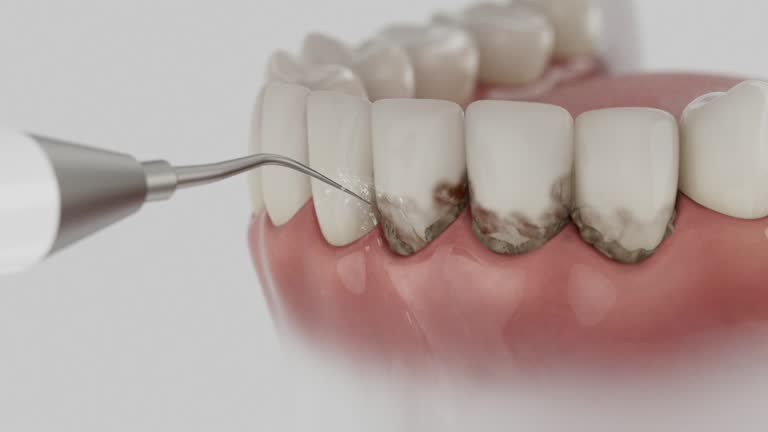 Reliable Dental contractor in Dennison, OH by Smile Center Dentistry